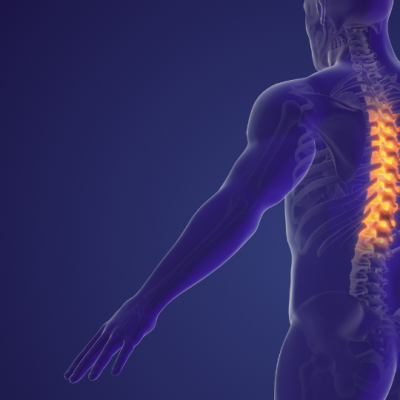 Prevalence, Prediction and Prevention of Spinal Pain in Rotary Wing Aircrew