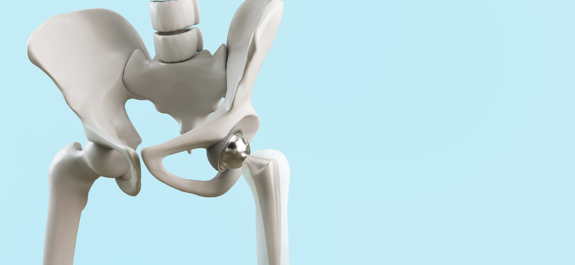 A deep learning method for radiological analysis of spinopelvic mobility