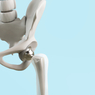 A deep learning method for radiological analysis of spinopelvic mobility