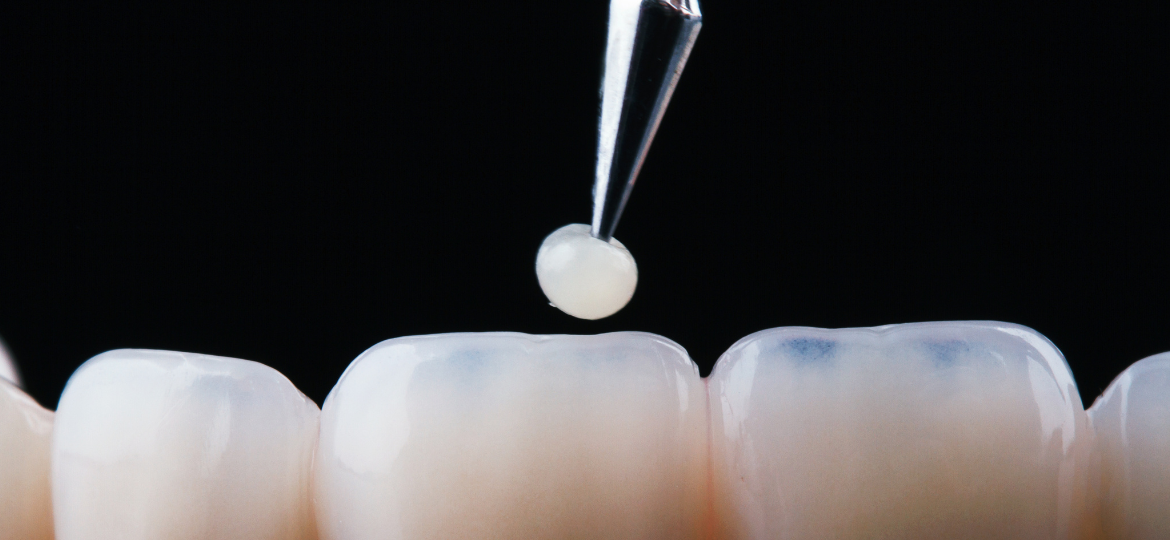 AI-assisted Multiscale Simulation Framework for Intentional Design of Dental Restorative Materials (Multiple Application)